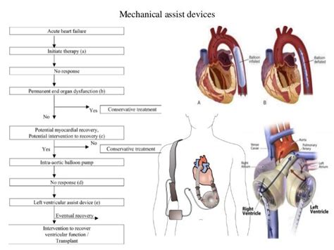 lvf medical abbreviation